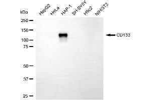 Western blotting analysis using CD133 antibody (ABIN7800959).