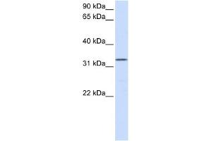 DOK5 antibody used at 1 ug/ml to detect target protein. (DOK5 antibody  (N-Term))