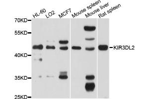 Western blot analysis of extracts of various cell lines, using KIR3DL2 antibody (ABIN4904158) at 1:1000 dilution. (KIR3DL2 antibody)