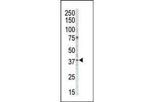 CSNK1A1 antibody  (C-Term)