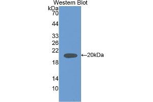 Detection of Recombinant IL18, Rat using Polyclonal Antibody to Interleukin 18 (IL18) (IL-18 antibody  (AA 37-194))