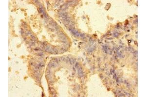 Immunohistochemistry of paraffin-embedded human endometrial tissue using ABIN7151123 at dilution of 1:100 (RNF13 antibody  (AA 432-685))