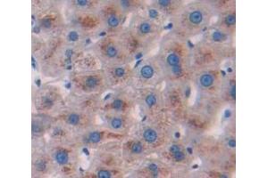 IHC-P analysis of Human Tissue, with DAB staining. (Glucuronidase beta antibody  (AA 451-649))