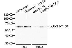 Western blot analysis of extracts of various cell lines, using Phospho-AKT1-T450 antibody. (AKT1 antibody  (pThr450))