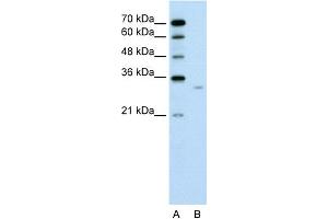 WB Suggested Anti-DCXR Antibody Titration:  0. (DCXR antibody  (Middle Region))