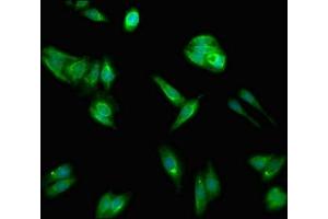 Immunofluorescent analysis of HepG2 cells using ABIN7158503 at dilution of 1:100 and Alexa Fluor 488-congugated AffiniPure Goat Anti-Rabbit IgG(H+L) (ACSL1 antibody  (AA 435-547))