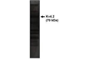 Image no. 1 for anti-Potassium Voltage-Gated Channel, Shal-Related Subfamily, Member 2 (KCND2) antibody (ABIN265029)