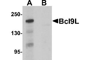 Western blot analysis of Bcl9L in HeLa cell lysate with Bcl9L antibody at 1 µg/mL in (A) the absence and (B) the presence of blocking peptide.
