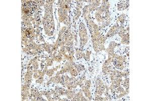 anti-ZW10 Interactor (ZWINT) (AA 29-249) antibody