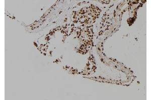 ABIN6276979 at 1/100 staining Rat lung tissue by IHC-P. (MCM6 antibody  (C-Term))
