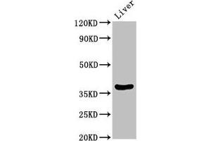 DDO anticorps  (AA 37-161)