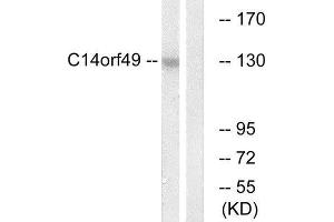 Western Blotting (WB) image for anti-Chromosome 14 Open Reading Frame 49 (C14orf49) (Internal Region) antibody (ABIN1851676)