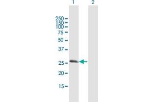 Western Blot analysis of RGS20 expression in transfected 293T cell line by RGS20 MaxPab polyclonal antibody. (RGS20 antibody  (AA 1-241))