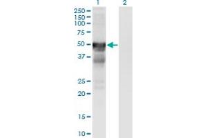 Western Blot analysis of RGMA expression in transfected 293T cell line by RGMA monoclonal antibody (M01), clone 6D7. (RGMA antibody  (AA 326-423))