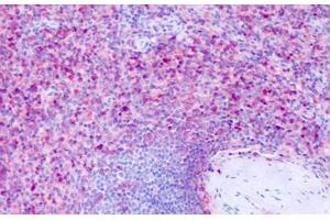 Anti-GPR63 antibody IHC staining of human spleen. (GPR63 antibody  (Cytoplasmic Domain))