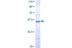 ABCC8 Protein (AA 611-710) (GST tag)