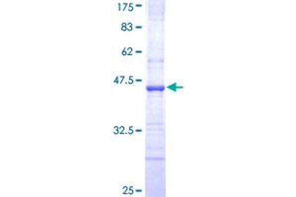 ABCC8 Protein (AA 611-710) (GST tag)
