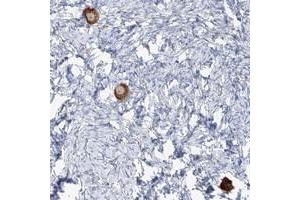 Immunohistochemical staining of human ovary with TMEM209 polyclonal antibody  shows strong cytoplasmic positivity in follicle cells at 1:200-1:500 dilution. (TMEM209 antibody)