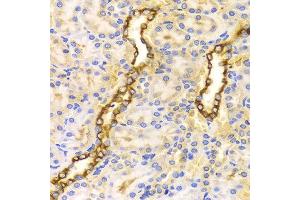 Immunohistochemistry of paraffin-embedded Rat kidney using CPT2 antibody at dilution of 1:100 (x400 lens). (CPT2 antibody)