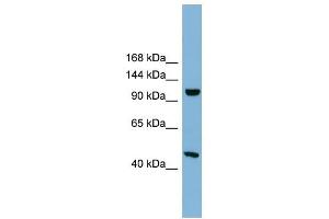 C17ORF71 antibody used at 1 ug/ml to detect target protein. (SMG8 antibody  (Middle Region))