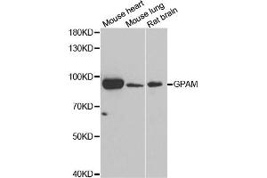 Western blot analysis of extracts of various cell lines, using GPAM antibody. (GPAM antibody)