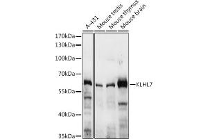 Western blot analysis of extracts of various cell lines, using KLHL7 antibody (ABIN7268080) at 1:3000 dilution. (KLHL7 antibody  (AA 200-300))