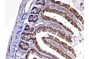 Immunohistochemistry (IHC) image for anti-Mediator Complex Subunit 9 (MED9) (AA 55-146) antibody (ABIN5519032)