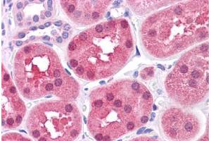 Human Kidney: Formalin-Fixed, Paraffin-Embedded (FFPE) (DBT antibody  (AA 35-84))