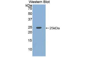 Western Blotting (WB) image for anti-KH Domain Containing, RNA Binding, Signal Transduction Associated 1 (KHDRBS1) (AA 156-381) antibody (ABIN1859527) (KHDRBS1 antibody  (AA 156-381))
