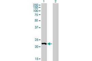 Western Blot analysis of HECTD2 expression in transfected 293T cell line by HECTD2 MaxPab polyclonal antibody. (HECTD2 antibody  (AA 1-207))