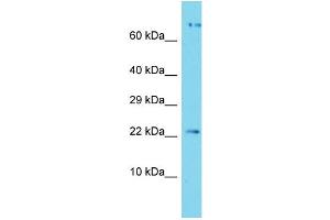 Host: Rabbit Target Name: APOPT1 Sample Type: Jurkat Whole Cell lysates Antibody Dilution: 1.