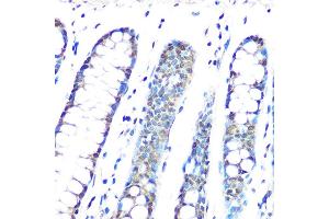 Immunohistochemistry of paraffin-embedded human colon using HP1 gamma/CBX3 Rabbit mAb (ABIN1679484, ABIN3018775, ABIN3018776 and ABIN7101659) at dilution of 1:100 (40x lens). (CBX3 antibody)