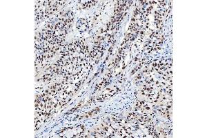 IHC analysis of SNRNP40 using anti-SNRNP40 antibody (ABIN7601719).
