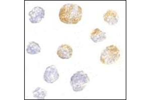 Immunocytochemistry of KIF5 in K562 cells with this product at 5 μg/ml. (KIF5A antibody  (C-Term))