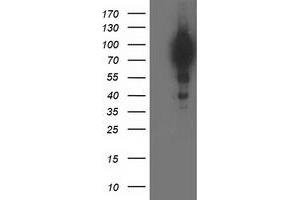 HEK293T cells were transfected with the pCMV6-ENTRY control (Left lane) or pCMV6-ENTRY BCAR1 (Right lane) cDNA for 48 hrs and lysed. (BCAR1 antibody)