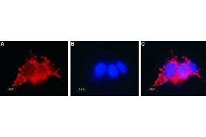 Expression of Connexin-26 in human HepG2 liver hepatocellular carcinoma cells - Immunocytochemical staining of fixed and permeabilized HepG2 liver hepatocellular carcinoma cells. (GJB2 antibody  (Intracellular))