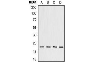 Western blot analysis of HOXB7 expression in A549 (A), HeLa (B), Raw264. (HOXB7 antibody  (Center))