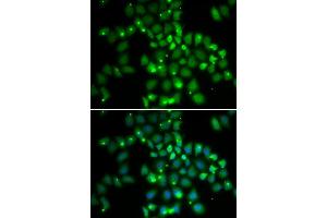 Immunofluorescence analysis of HeLa cell using PCGF6 antibody. (PCGF6 antibody)