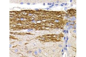 Immunohistochemistry of paraffin-embedded Rat brain using NEFL Polyclonal Antibody at dilution of 1:200 (40x lens). (NEFL antibody)