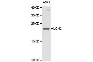 Western blot analysis of extracts of A-549 cells, using LCN2 antibody. (Lipocalin 2 antibody)