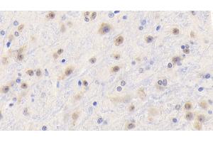 Detection of TNFa in Mouse Cerebrum Tissue using Polyclonal Antibody to Tumor Necrosis Factor Alpha (TNFa) (TNF alpha antibody  (AA 80-235))