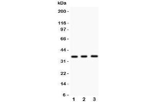 Western blot testing of Nkx2-5 antibody and Lane 1:  mouse spleen;  2: mouse heart;  3: human HeLa lysate. (NK2 Homeobox 5 antibody  (Middle Region))