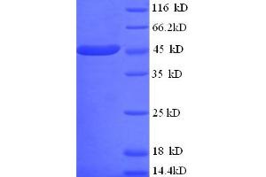 LldD (AA 1-396), (full length) protein (His tag)