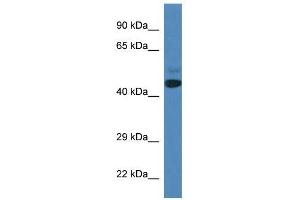 Western Blot showing SPRYD3 antibody used at a concentration of 1 ug/ml against Fetal Heart Lysate (SPRYD3 antibody  (N-Term))