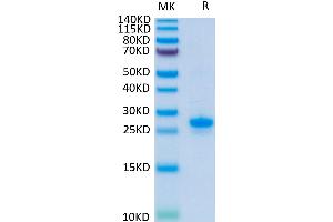 Human VEGF165 on Tris-Bis PAGE under reduced condition. (VEGF 165 (AA 27-191) protein (His-Avi Tag))