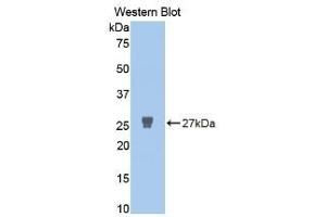 Detection of Recombinant MMP2, Human using Polyclonal Antibody to Matrix Metalloproteinase 2 (MMP2) (MMP2 antibody  (AA 445-660))