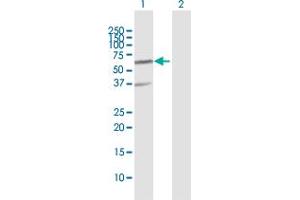 Western Blot analysis of RNF25 expression in transfected 293T cell line by RNF25 MaxPab polyclonal antibody. (RNF25 antibody  (AA 1-459))