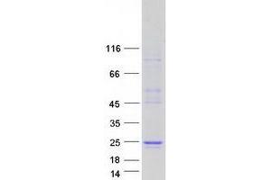 Western Blotting (WB) image for FEV (ETS Oncogene Family) (FEV) protein (Myc-DYKDDDDK Tag) (ABIN2721025)