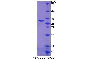 SDS-PAGE (SDS) image for BCL2-Like 1 (BCL2L1) (AA 2-212) protein (His tag) (ABIN1078941)