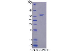 SDS-PAGE analysis of Human RFC2 Protein. (RFC2 Protein)